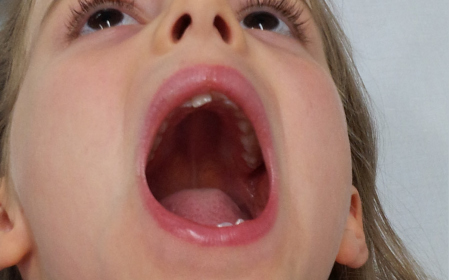 paediatric_sleep_apnoea